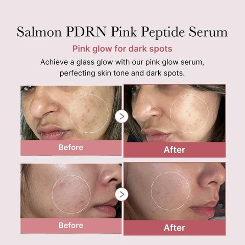 Medicube PDRN Pink Peptide Serum 30ml - naturvida.pt